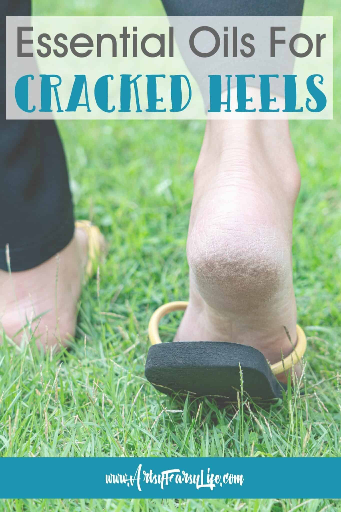 Essential Oils For Cracked Heels · Artsy Fartsy Life