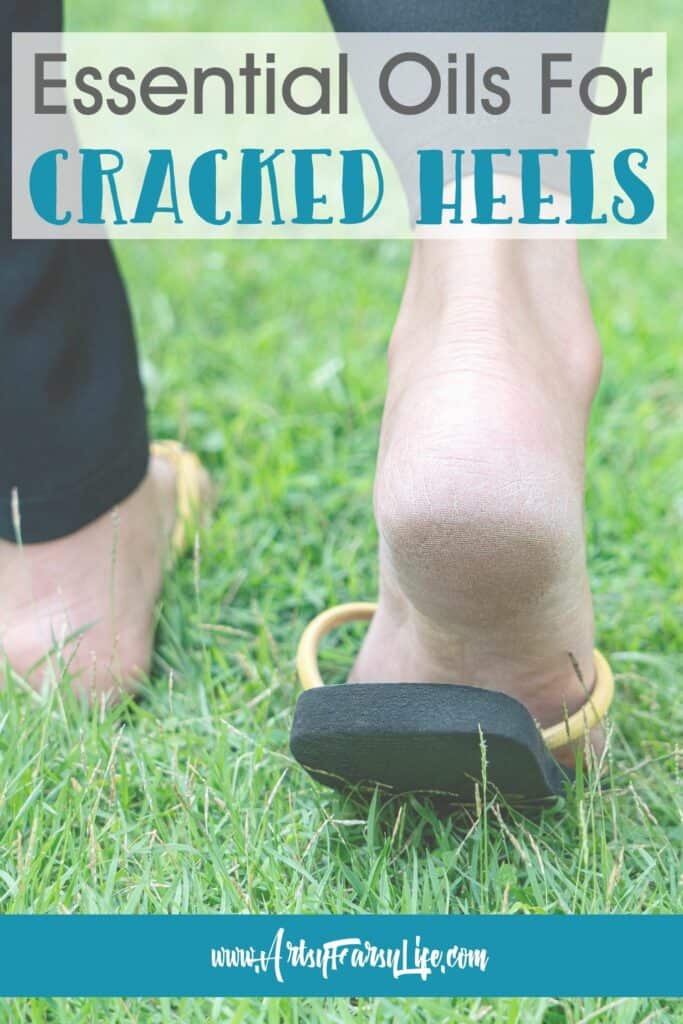 Essential Oils For Cracked Heels